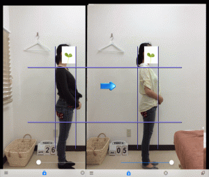 産後骨盤矯正ビフォーアフター横向きの画像
