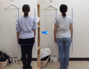 さらにプラス4回整体を加えたことで（ビフォーアフター画像あり）