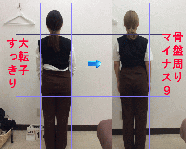 産後４ヶ月からご来院いただきました