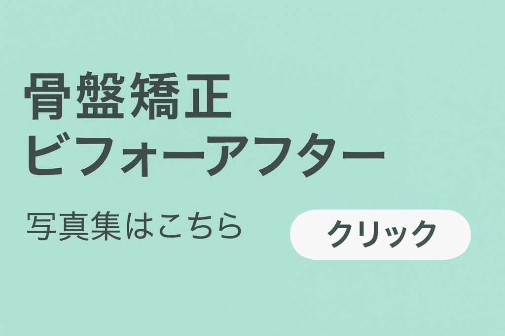 骨盤矯正ビフォーアフター写真集のバナーで、読者を誘導してる画像