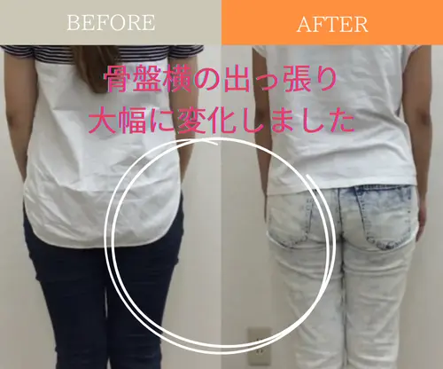 パンツラインに余裕