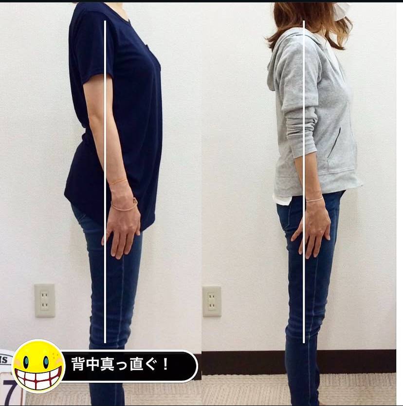 反り腰が改善した女性のビフォーアフター写真