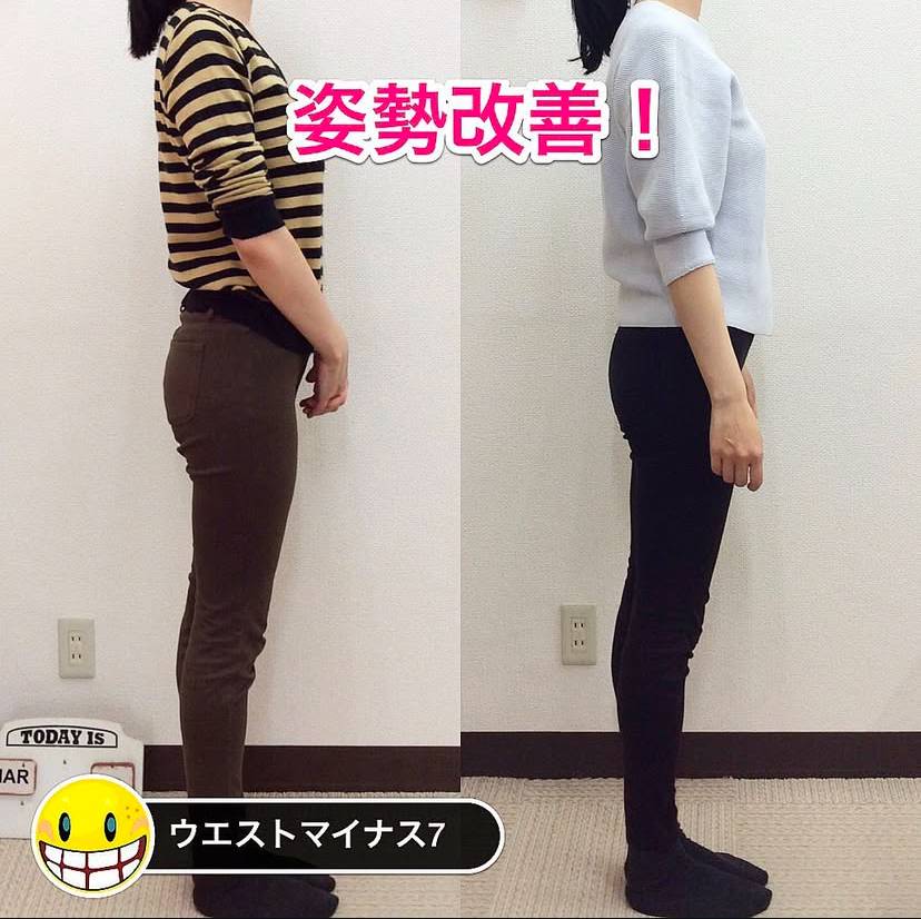 反り腰でお悩みだった府中市の女性、施術前の横姿勢。腰が反ってお腹が前に突き出た状態