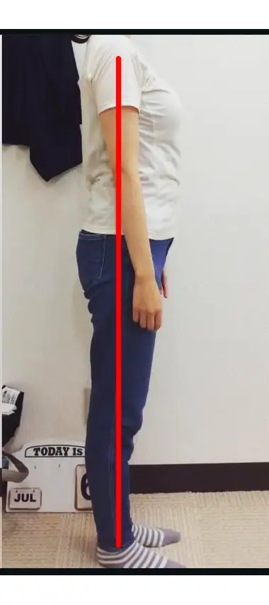 猫背・巻き肩の施術後写真｜胸が開き姿勢がまっすぐになった様子