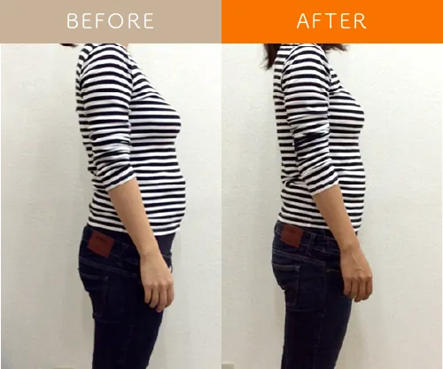 施術によって前に出たお腹や姿勢が整ったビフォーアフター写真（体幹安定）