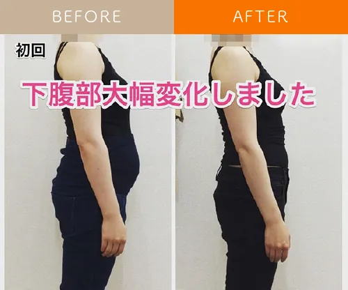 産後の骨盤ケアを受けるママのイメージ写真
