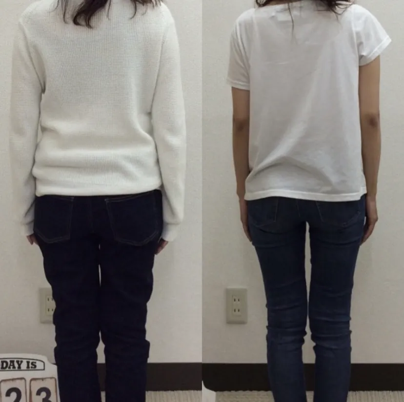 産後骨盤矯正を継続した後の後ろ姿。骨盤が引き締まり、お尻の形が整い始めている様子