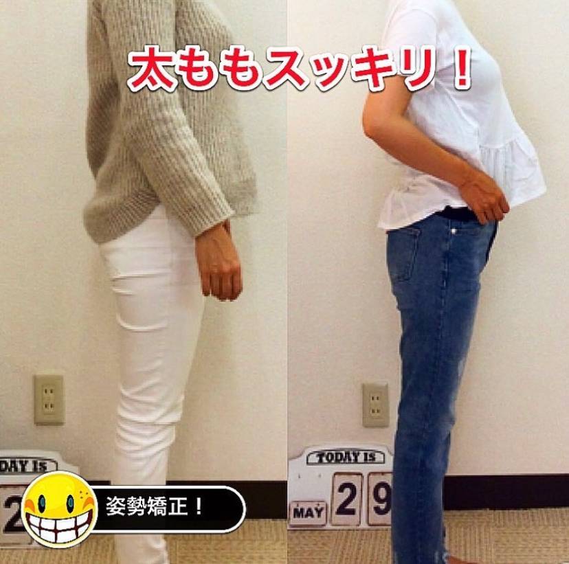 太ももがスッキリしたビフォーアフター