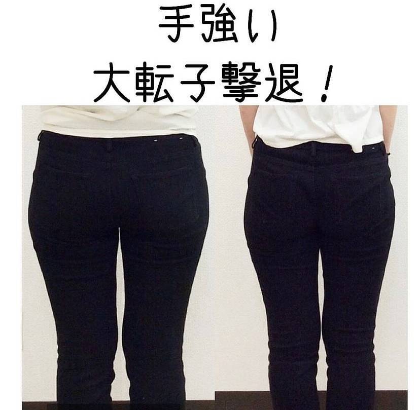 大転子撃退のビフォーアフター