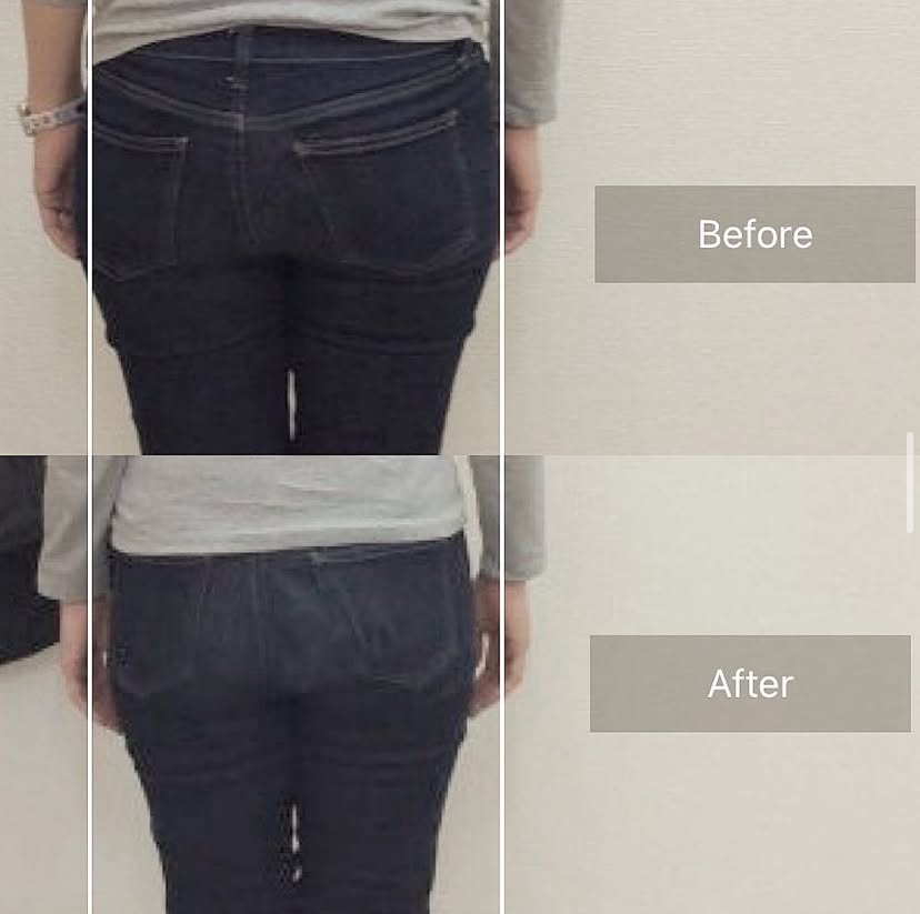 産後骨盤矯正の変化2