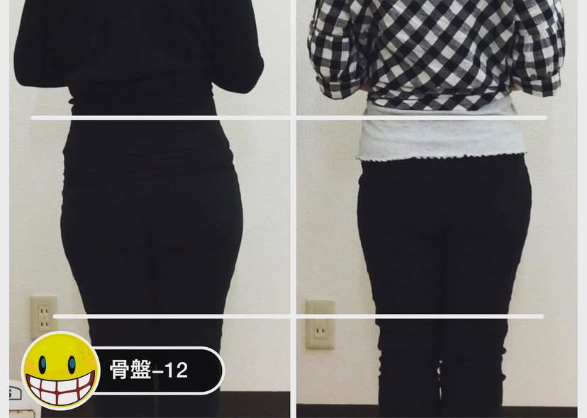 産後骨盤矯正の変化1