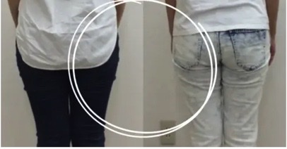 産後の大転子まわりを整える整体施術の様子