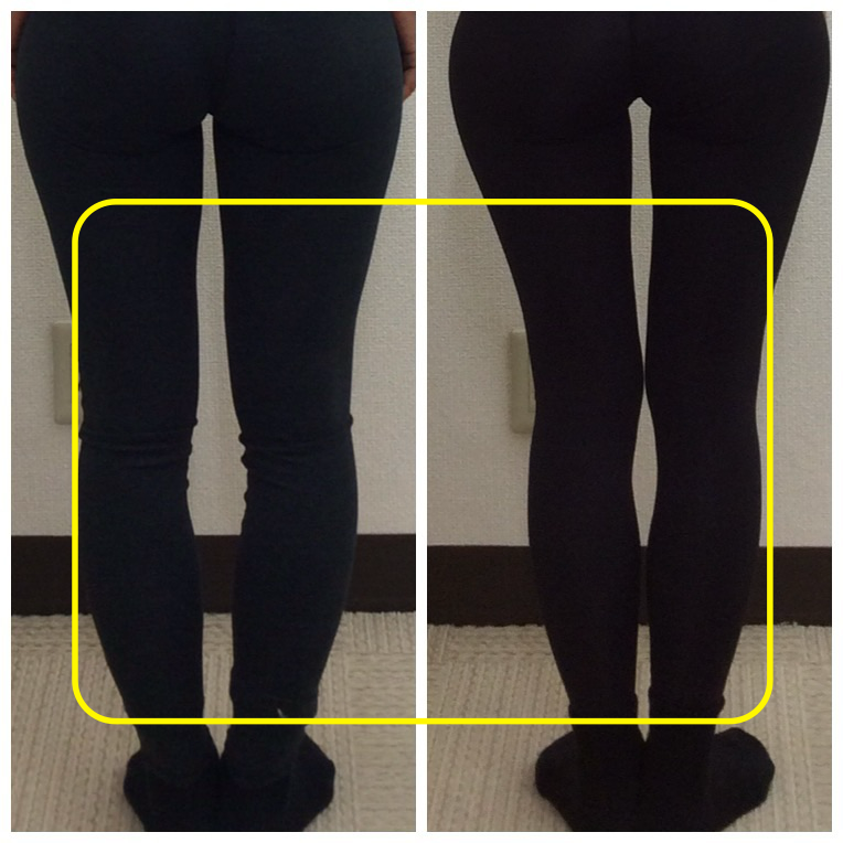骨盤角度が整い横幅がコンパクトに