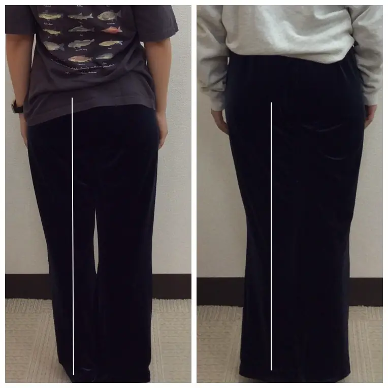 産後O脚のビフォーアフター写真（中心ラインの変化）